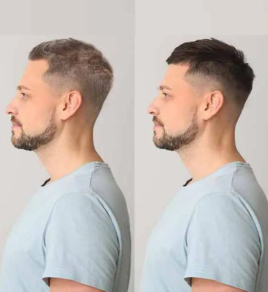 Spray Particle – Serum Reparador para Canas (Restaura el Color y el Brillo Natural)